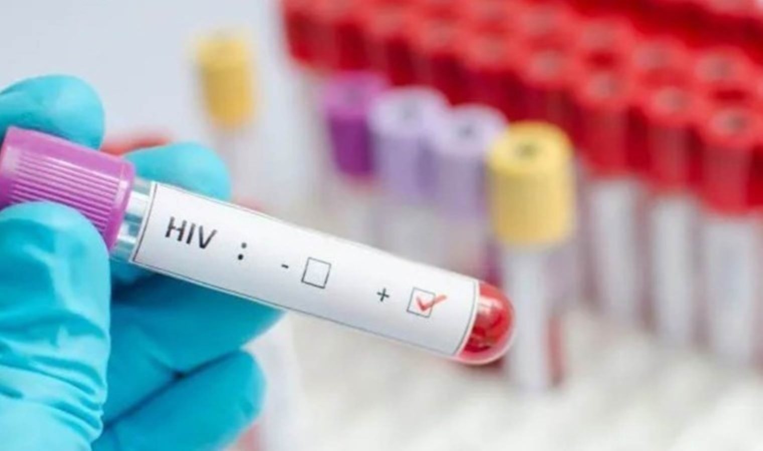 İzmir’de 13 yaşındaki bir çocuk AIDS’ten ölmüştü: İl Sağlık Müdürlüğü’nden açıklama